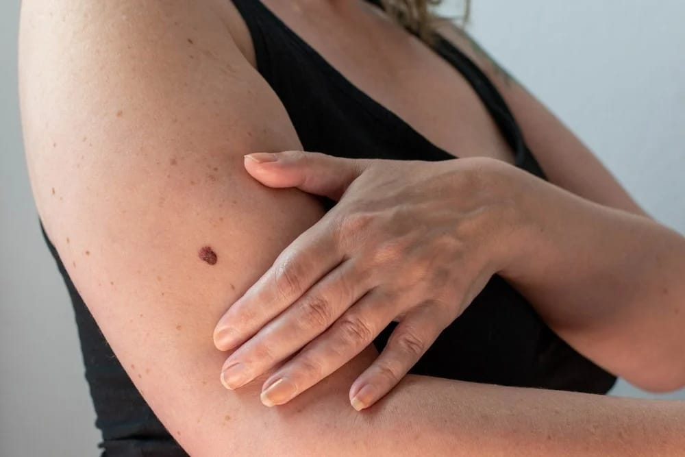Umfassende dermatologische Behandlungen: Dr. Balázs setzt auf persönliche Fürsorge