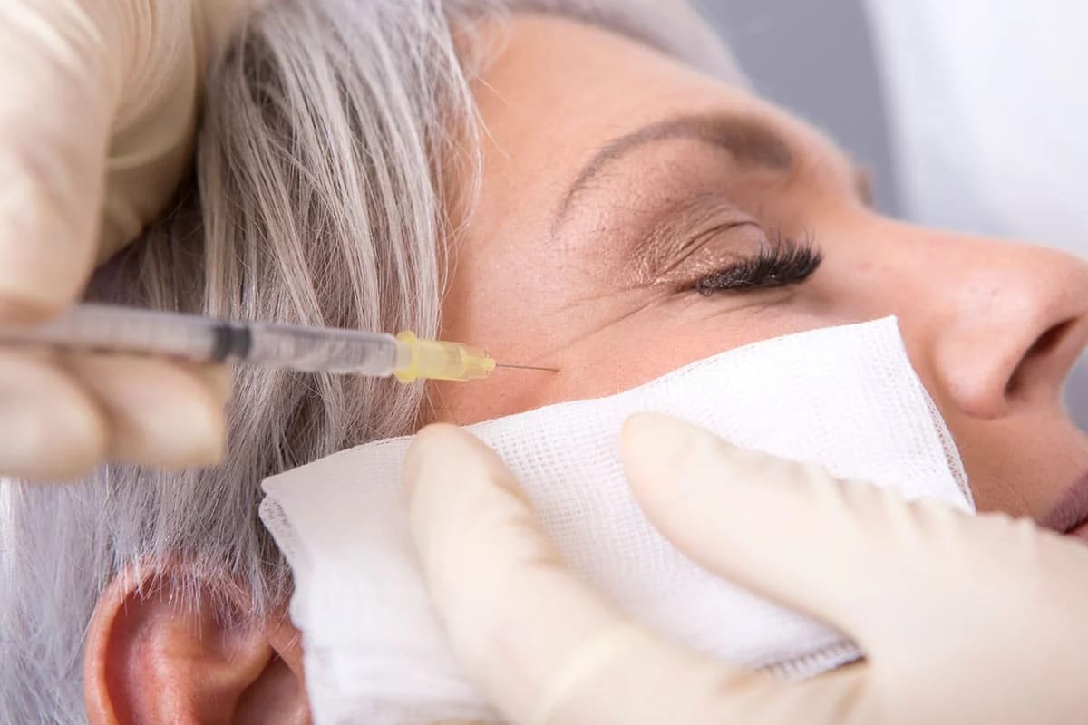 Jugendlichere Haut mit Botox Nürnberg